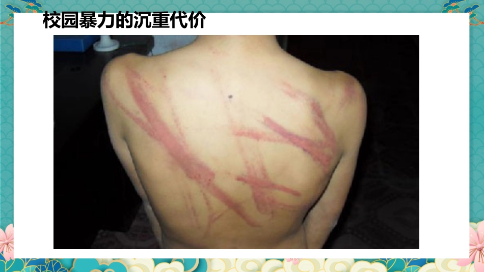 【通用】【校园霸凌】拒绝打架斗殴主题班会:一拳头一仇人,一击掌一朋友_第10页